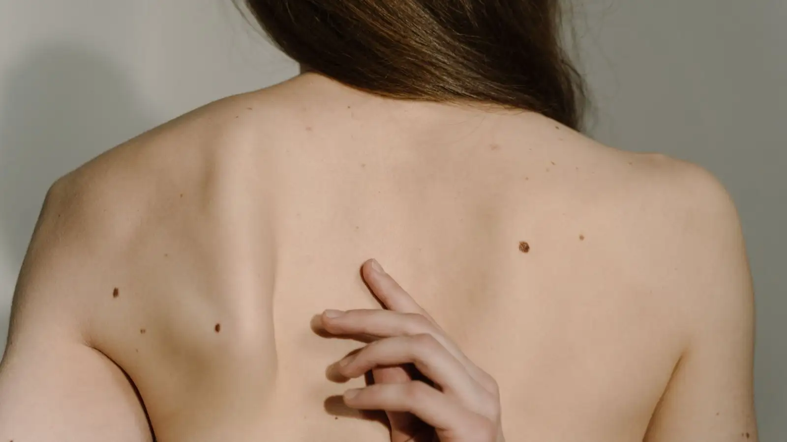 Grain de beauté : les signes qui doivent alerter